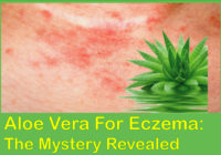 Aloe vera for eczema