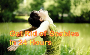 get rid of scabies in 24 hours