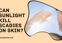 Can Sunlight Kill Scabies On Skin