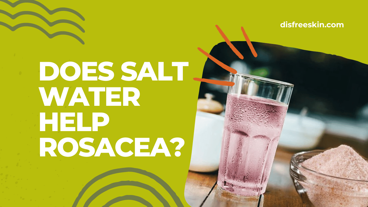 Does Salt Water Help Rosacea