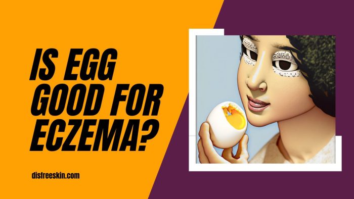 Is Egg Good For Eczema