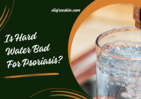 Is Hard Water Bad For Psoriasis