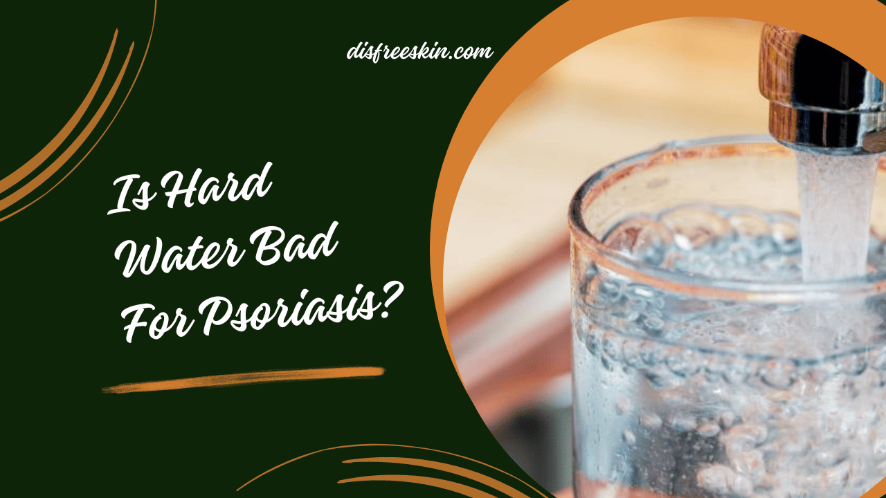 Is Hard Water Bad For Psoriasis